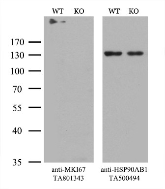 Ki67 Antibody