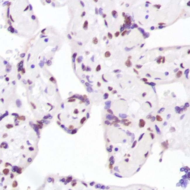 Ku80 Antibody in Immunohistochemistry (IHC)