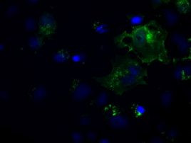 L1CAM Antibody in Immunocytochemistry (ICC/IF)