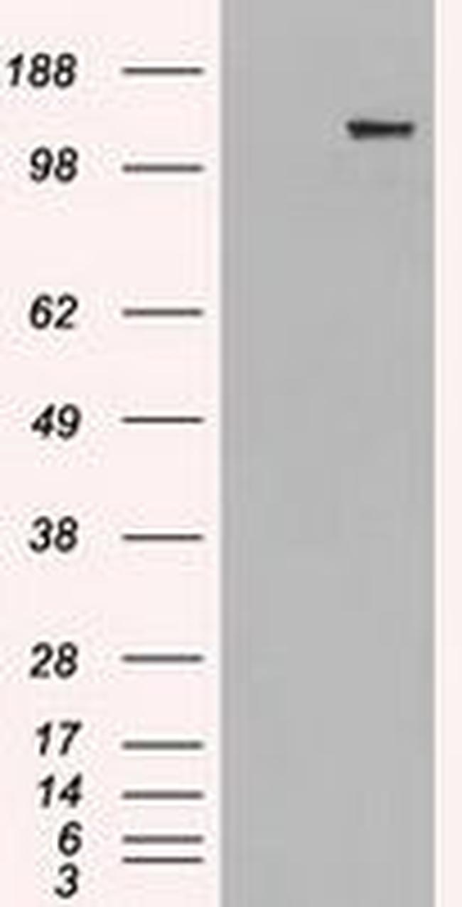 L1CAM Antibody in Western Blot (WB)