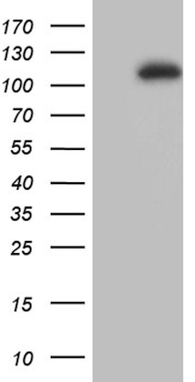 L3MBTL3 Antibody in Western Blot (WB)
