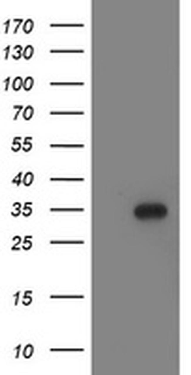 LACTB2 Antibody in Western Blot (WB)