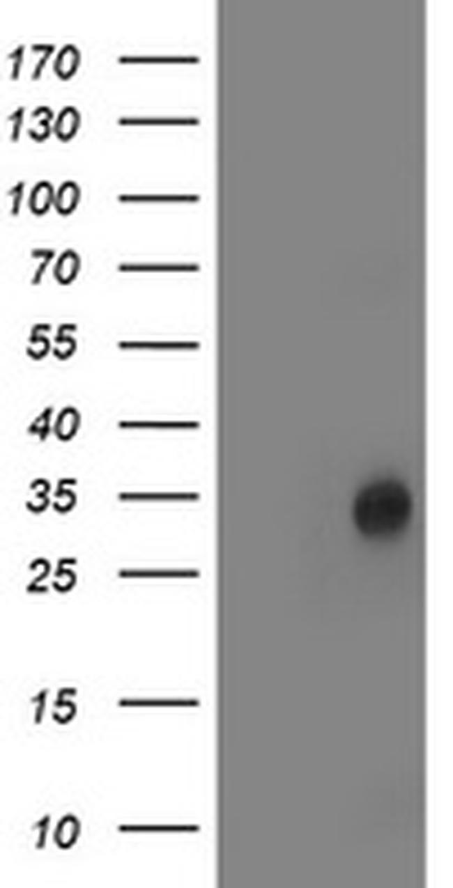 LACTB2 Antibody in Western Blot (WB)