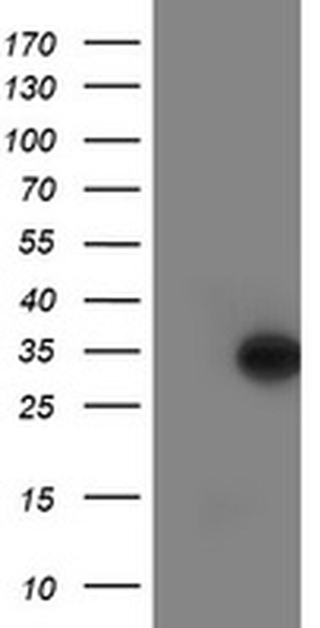 LACTB2 Antibody in Western Blot (WB)