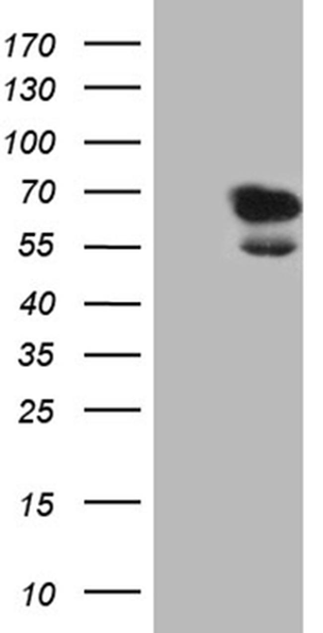 LAD1 Antibody in Western Blot (WB)