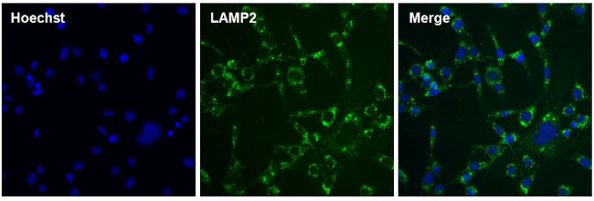 LAMP2 Antibody in Immunocytochemistry (ICC/IF)