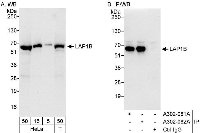 LAP1B Antibody in Western Blot (WB)