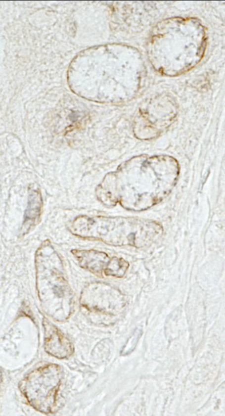 LAP1B Antibody in Immunohistochemistry (IHC)