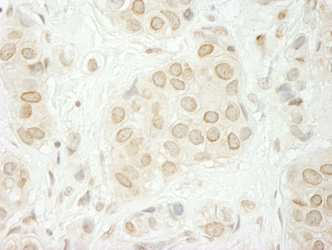 LAP1B Antibody in Immunohistochemistry (IHC)