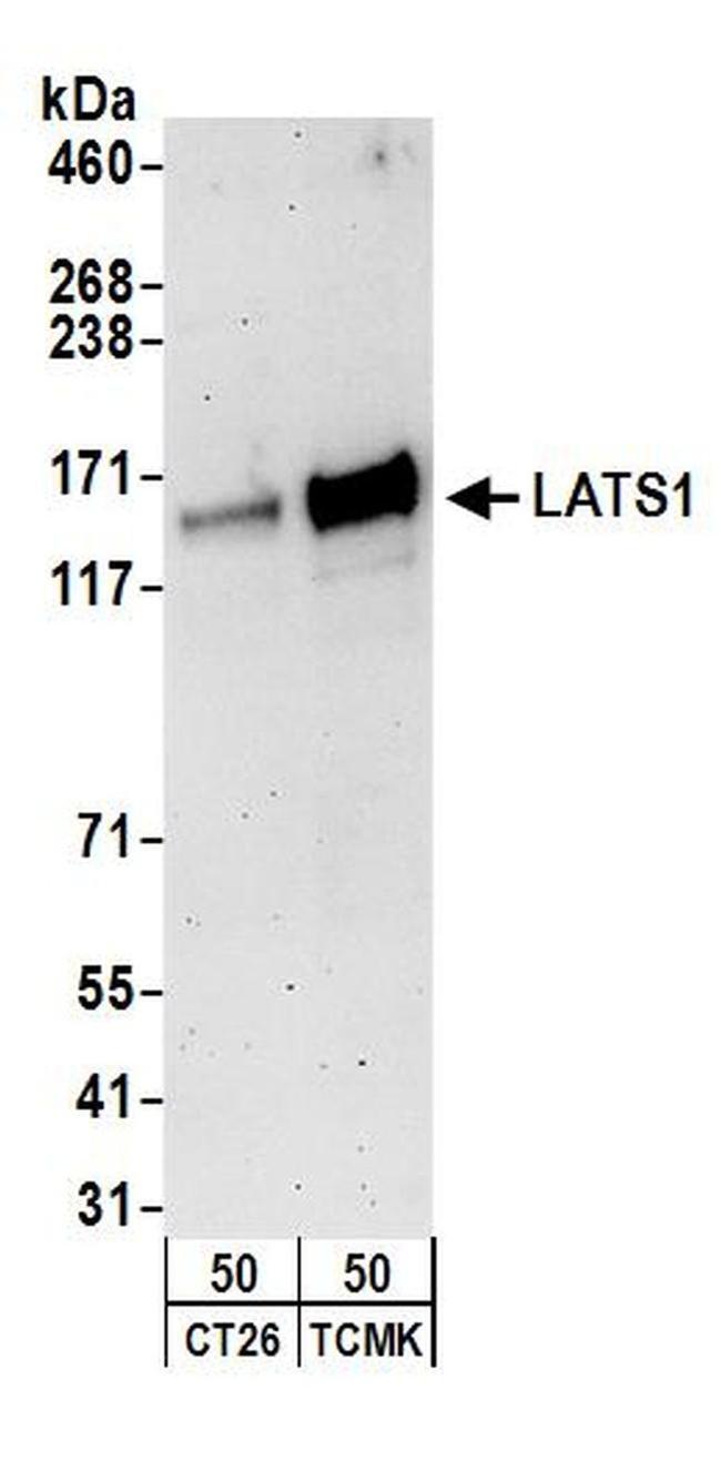 LATS1 Antibody in Western Blot (WB)