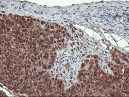 LCMT1 Antibody in Immunohistochemistry (Paraffin) (IHC (P))