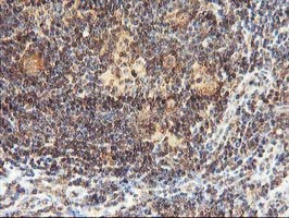 LCMT1 Antibody in Immunohistochemistry (Paraffin) (IHC (P))