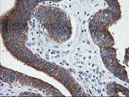 LCMT1 Antibody in Immunohistochemistry (Paraffin) (IHC (P))