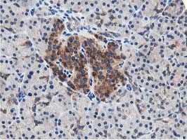 LCMT1 Antibody in Immunohistochemistry (Paraffin) (IHC (P))