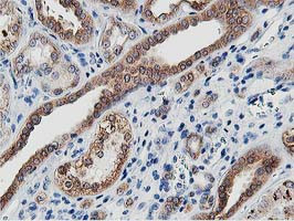 LCMT1 Antibody in Immunohistochemistry (Paraffin) (IHC (P))