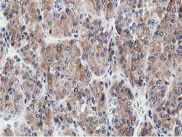 LCMT1 Antibody in Immunohistochemistry (Paraffin) (IHC (P))