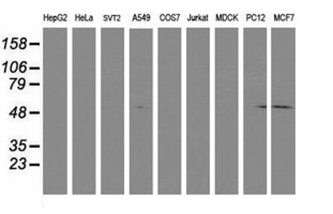 LCMT1 Antibody in Western Blot (WB)