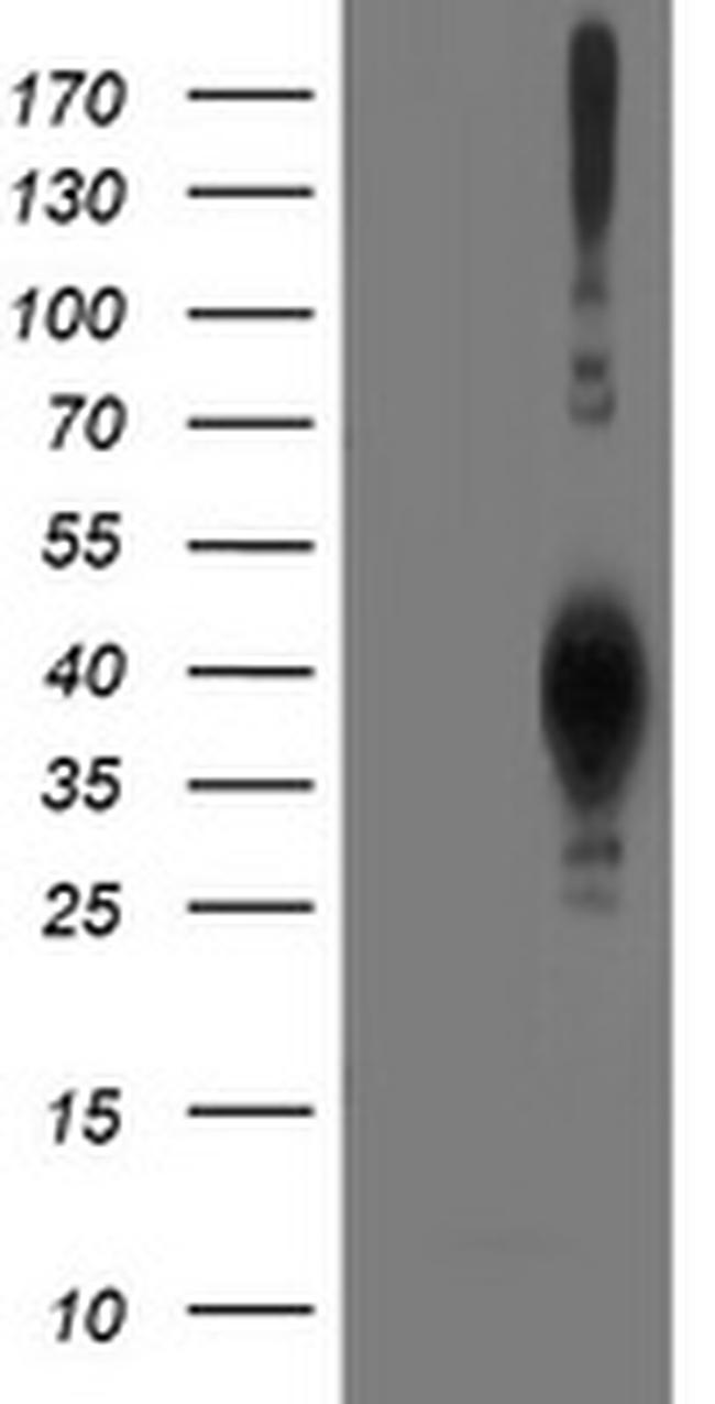 LCMT1 Antibody in Western Blot (WB)