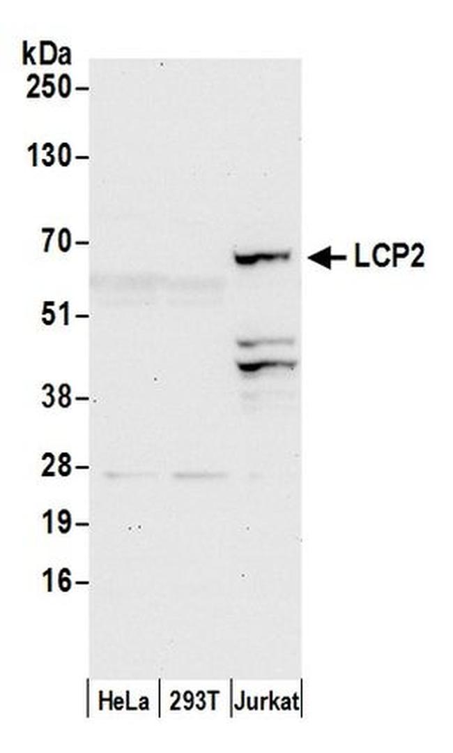 LCP2/SLP76 Antibody in Western Blot (WB)