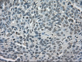 LDHA Antibody in Immunohistochemistry (Paraffin) (IHC (P))