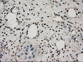 LDHA Antibody in Immunohistochemistry (Paraffin) (IHC (P))