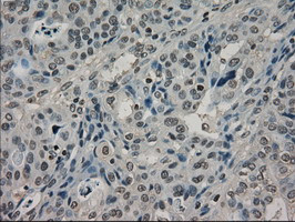 LDHA Antibody in Immunohistochemistry (Paraffin) (IHC (P))