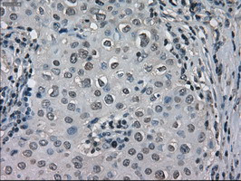 LDHA Antibody in Immunohistochemistry (Paraffin) (IHC (P))