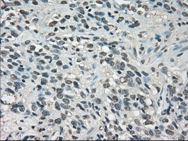 LDHA Antibody in Immunohistochemistry (Paraffin) (IHC (P))