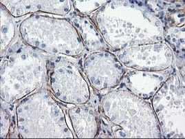 LDLRAP1 Antibody in Immunohistochemistry (Paraffin) (IHC (P))