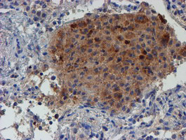 LECT2 Antibody in Immunohistochemistry (Paraffin) (IHC (P))