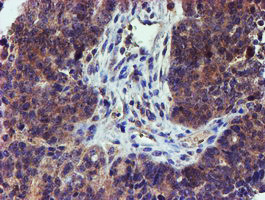 LECT2 Antibody in Immunohistochemistry (Paraffin) (IHC (P))