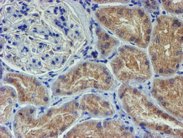 LECT2 Antibody in Immunohistochemistry (Paraffin) (IHC (P))