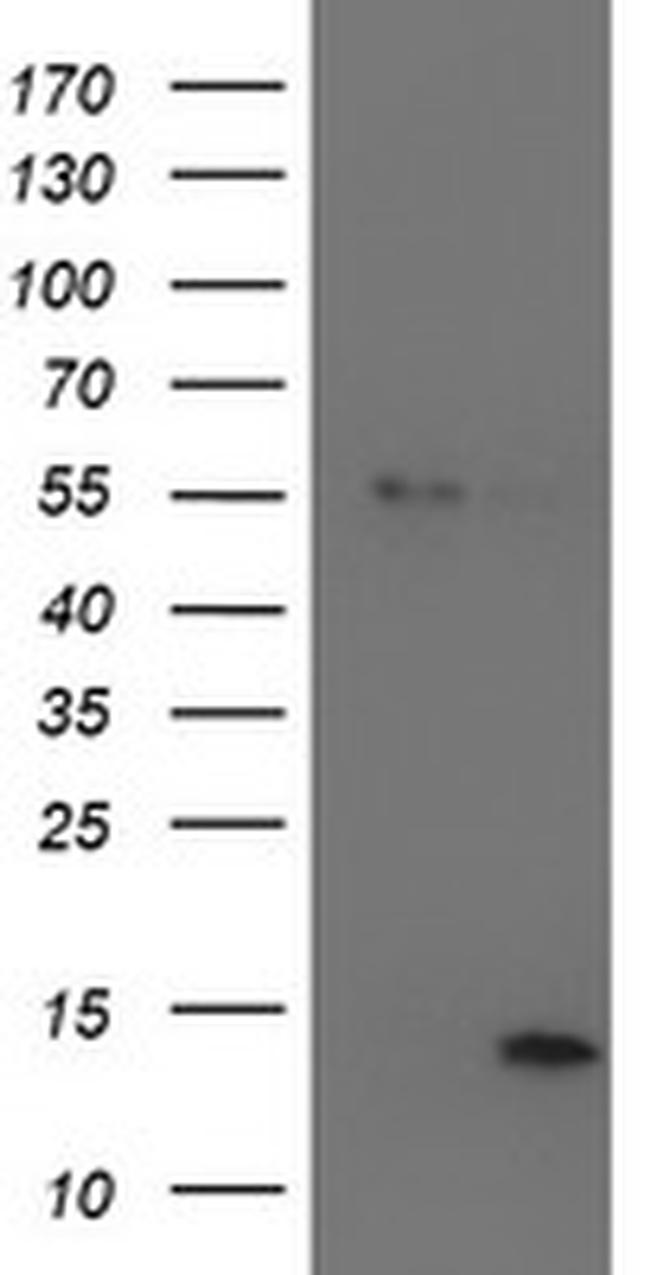 LECT2 Antibody in Western Blot (WB)