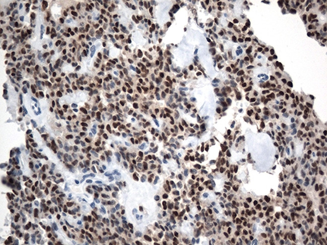 LEF1 Antibody in Immunohistochemistry (Paraffin) (IHC (P))