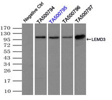 LEMD3 Antibody in Immunoprecipitation (IP)