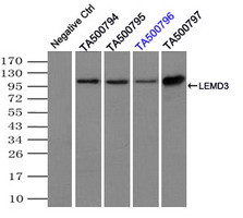 LEMD3 Antibody in Immunoprecipitation (IP)