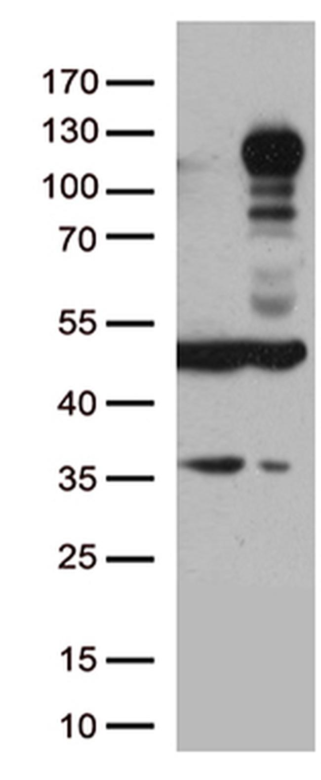 LEMD3 Antibody in Western Blot (WB)