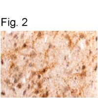 Leptin Antibody in Immunohistochemistry (IHC)