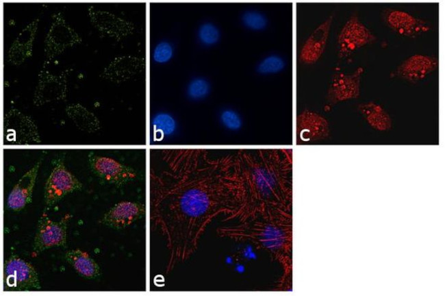 Glutamine Synthetase Antibody in Immunocytochemistry (ICC/IF)