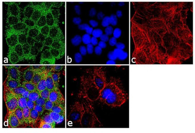 SOD2 Antibody in Immunocytochemistry (ICC/IF)