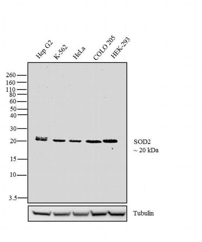 SOD2 Antibody in Western Blot (WB)