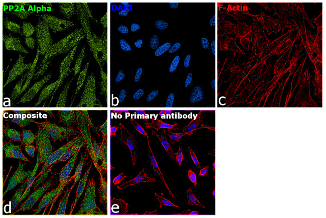 PP2A alpha Antibody in Immunocytochemistry (ICC/IF)