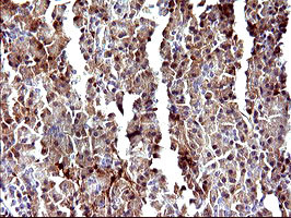 LGALS3 Antibody in Immunohistochemistry (Paraffin) (IHC (P))