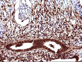 LGALS3 Antibody in Immunohistochemistry (Paraffin) (IHC (P))