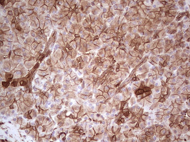 LGALS9 Antibody in Immunohistochemistry (Paraffin) (IHC (P))