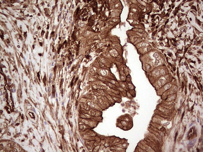 LGALS9 Antibody in Immunohistochemistry (Paraffin) (IHC (P))