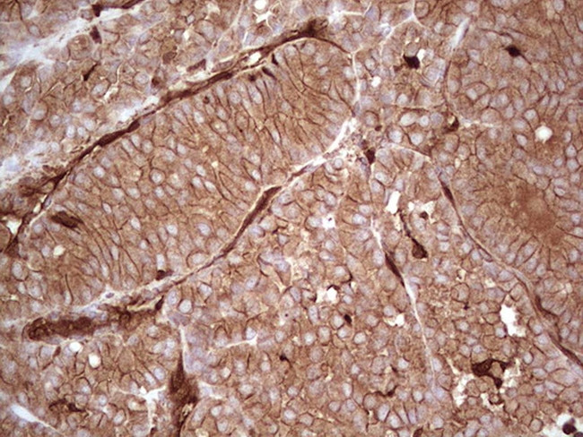 LGALS9 Antibody in Immunohistochemistry (Paraffin) (IHC (P))