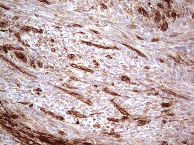 LGALS9 Antibody in Immunohistochemistry (Paraffin) (IHC (P))