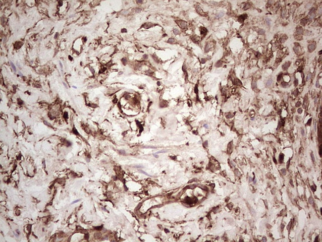 LGALS9 Antibody in Immunohistochemistry (Paraffin) (IHC (P))