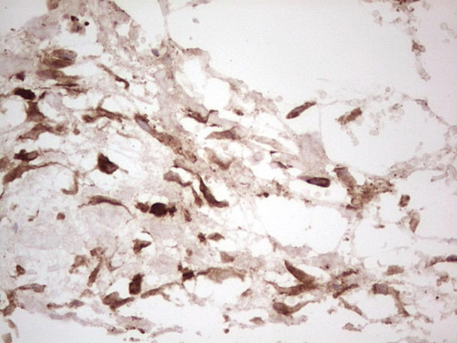 LGALS9 Antibody in Immunohistochemistry (Paraffin) (IHC (P))